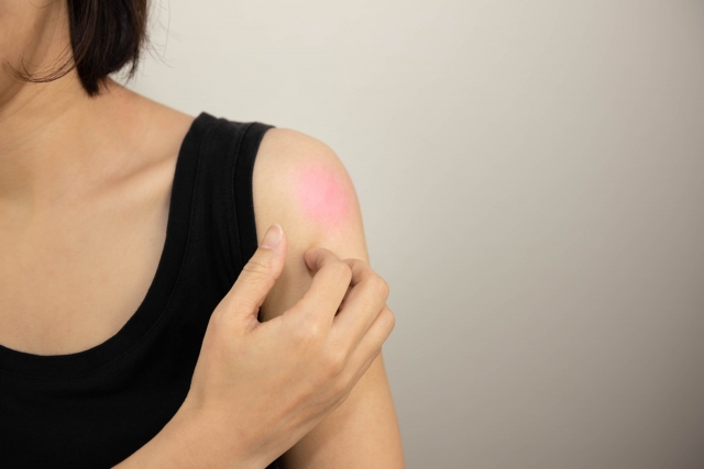 害虫駆除：ノミによる被害